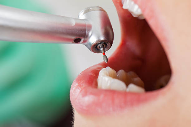 Best Emergency Dentist for Knocked-Out Tooth in Rolla, MO